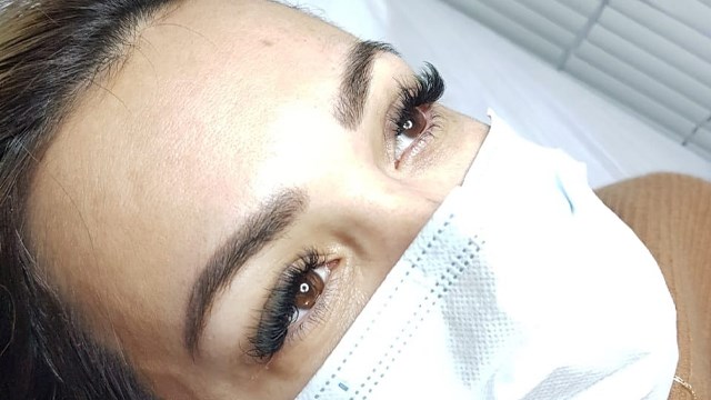 ისარგებლე ფასდაკლებით სახის ღრმა წმენდაზე Esthetic Studio ესთეტიკ სტუდიო-გან image 9