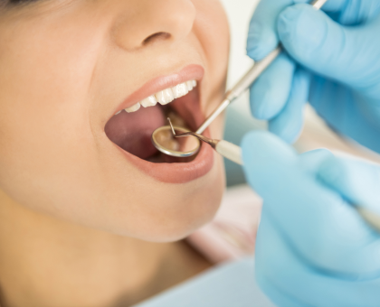  სიბრძნის კბილის ამოღება + ანესთეზია