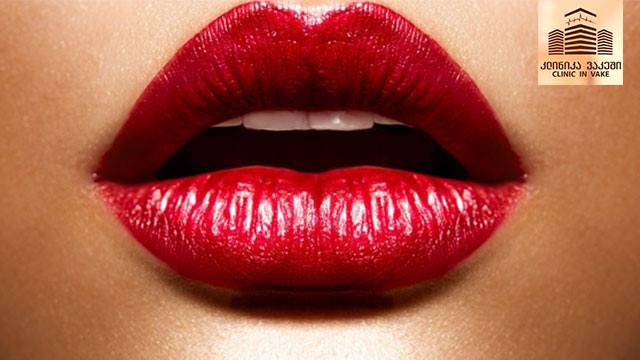 20 ლარად, 40%-იანი ფასდაკლების Swooper Code-ი ტუჩის მოცულობის გაზრდაზე ბუნებრივი შემავსებლით «კლინიკა ვაკეში» image 0