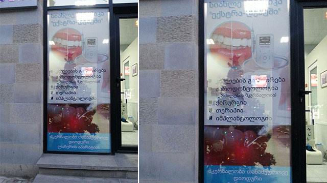 20 ლარად, 35%-იანი ფასდაკლების Swooper Code-ი მეტალის ბრეკეტებზე  «Extra Dent-ისგან» image 1